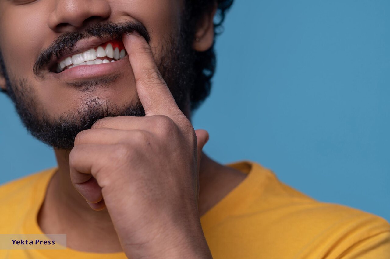 از معجزه محلول گلاب و سرکه برای ضدعفونی کردن دهان خبر دارید؟