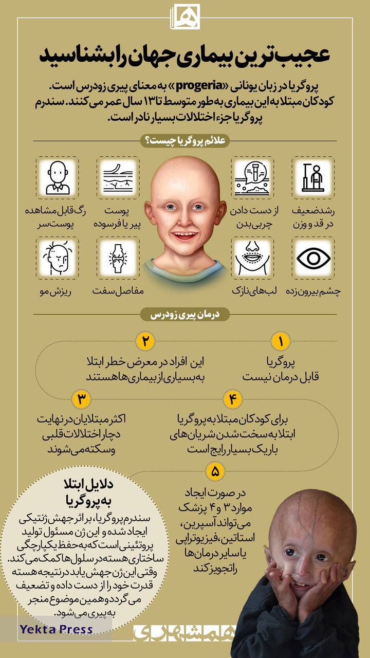 عجیب‌ترین بیماری جهان را بشناسید