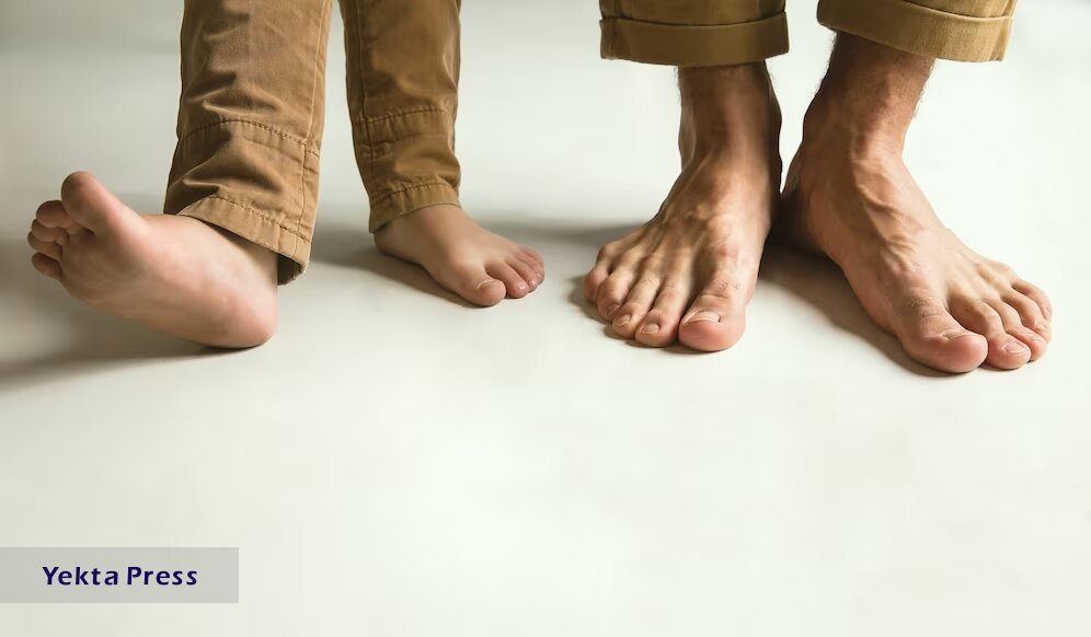روش تشخیص کف پای صاف در کودکان