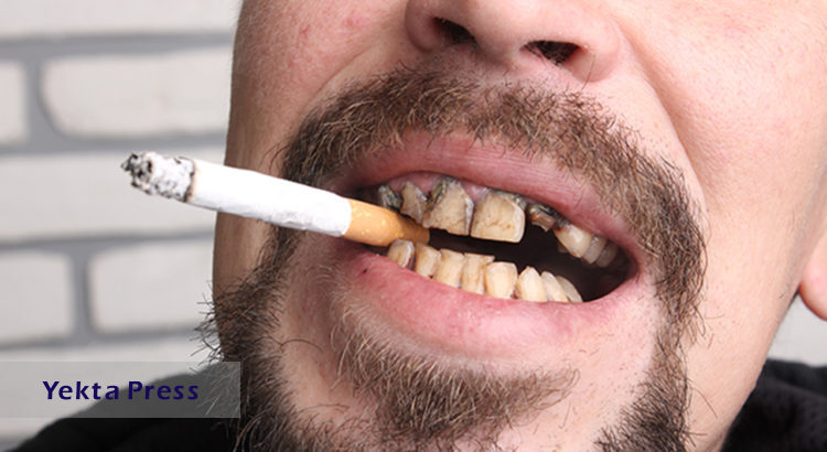 5 روش برای از بین بردن بوی بد دهان ناشی از سیگار کشیدن
